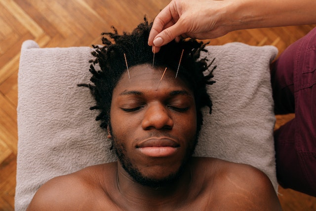 Guy with eyes closed getting acupuncture on the forehead