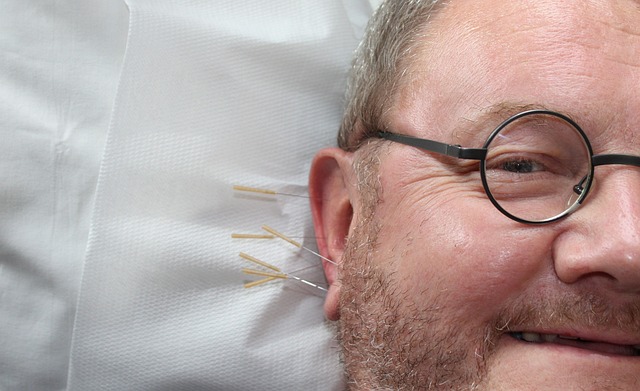 Person getting his ear pricked with needles at an acupuncture session